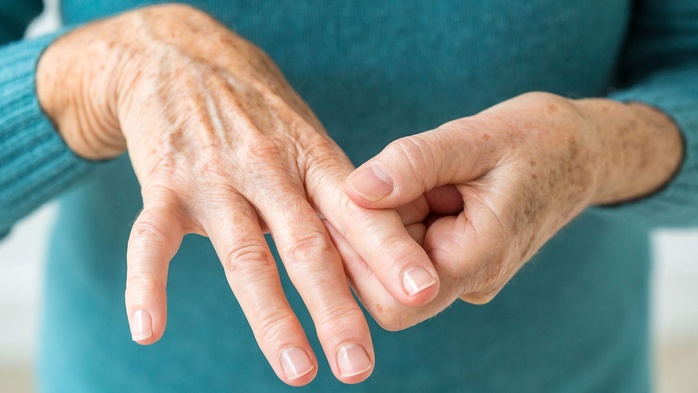Rheumatoid arthritis adalah penyakit