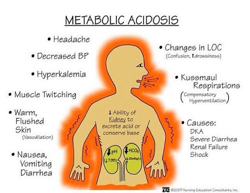 Apa yang dimaksud dengan Asidosis? - Ilmu Kedokteran - Dictio Community