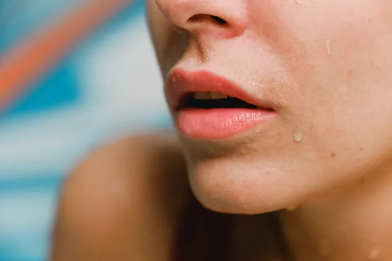 Bukan Cuma Kulit, Bibir Juga Bisa Terbakar Matahari: Bahaya Hidden Sunburn dan Cara Mencegahnya